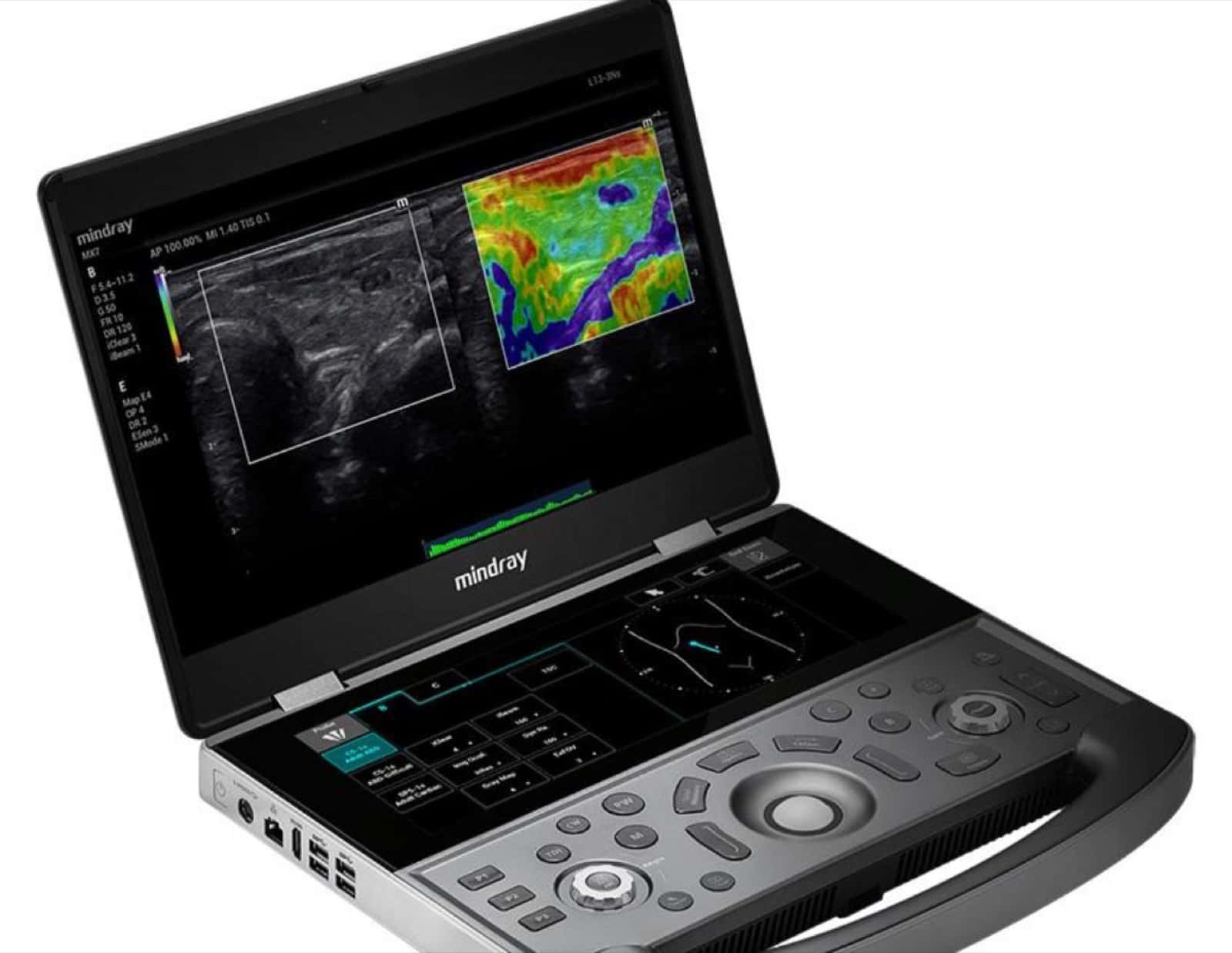 Vascular diagnostic equipment in an accredited practice